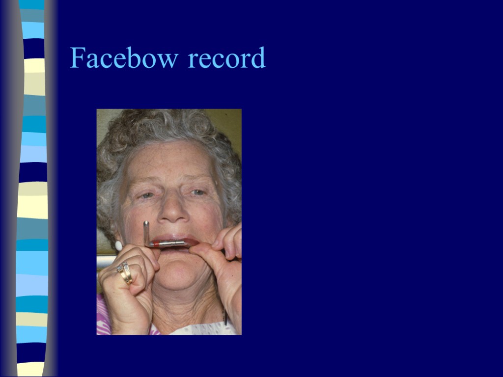 Facebow record